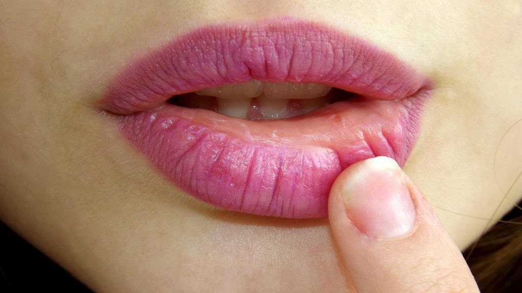 Best Lip Balms for Dry Lips Best Lip Balms for Dry Lips
