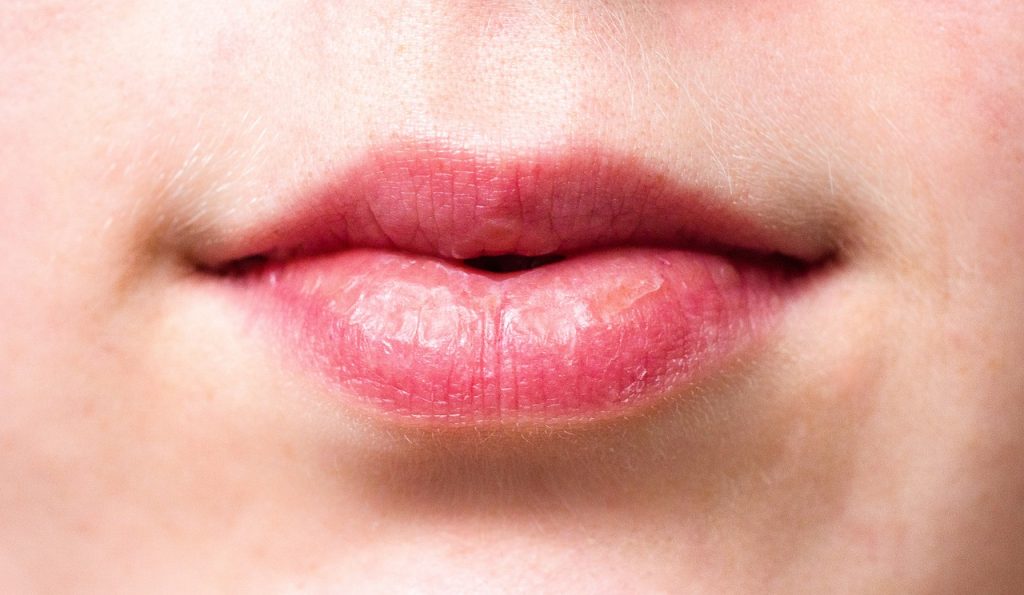 Best Lip Balms for Dry Lips Best Lip Balms for Dry Lips